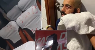 Brezilya'da Takım Otobüsüne Bombalı Saldırı: 6 Futbolcu Yaralandı, Maçlara Çıkmama Kararı