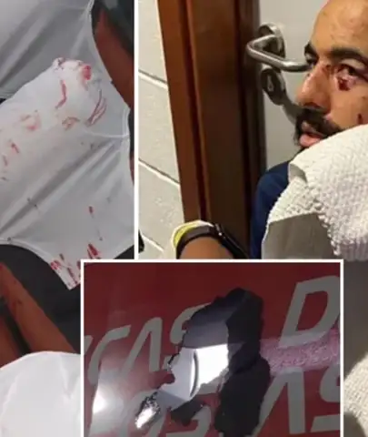 Brezilya'da Takım Otobüsüne Bombalı Saldırı: 6 Futbolcu Yaralandı, Maçlara Çıkmama Kararı